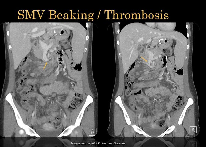 AZ Damiaan Ostend EPOS™ photo