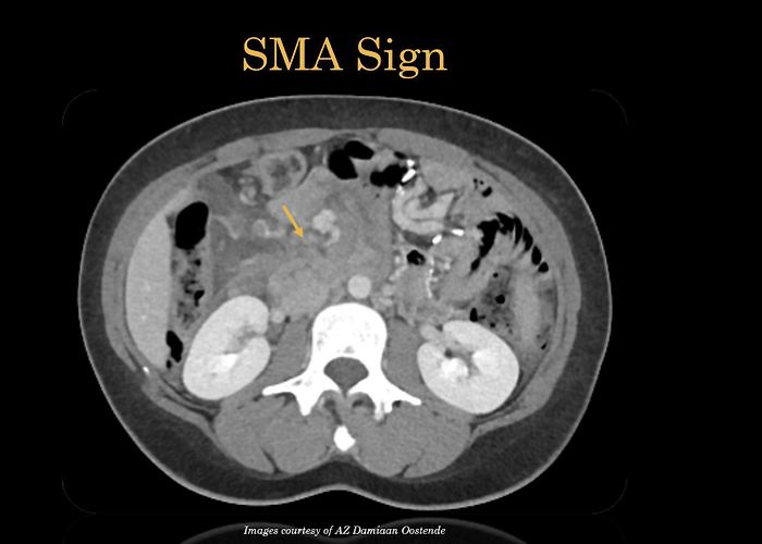 AZ Damiaan Ostend EPOS™ photo